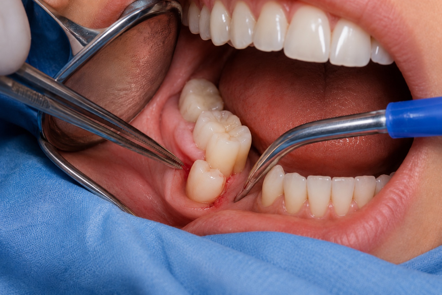 Cirurgia