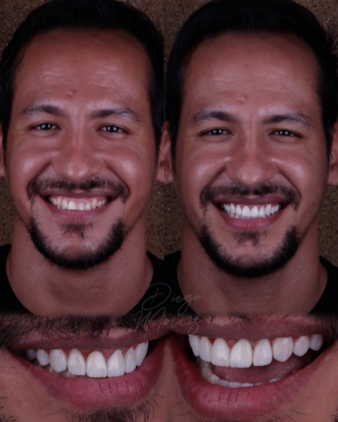 Resultado 3